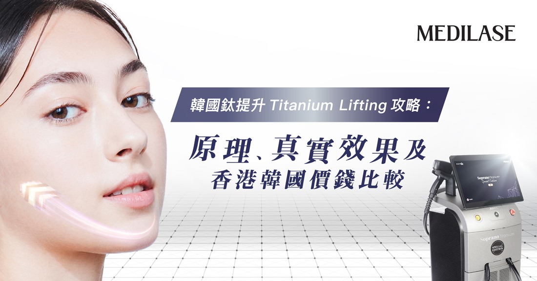 韓國鈦提升 Titanium Lifting 療程介紹及香港價錢比較