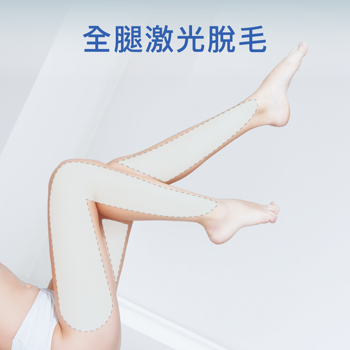 全腿激光脫毛療程