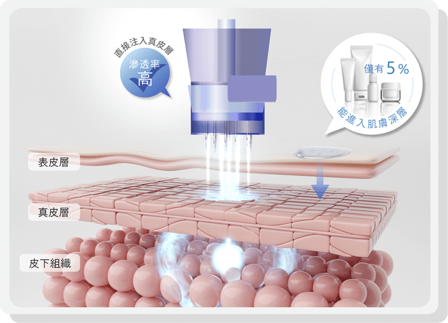hydroinjection infographic