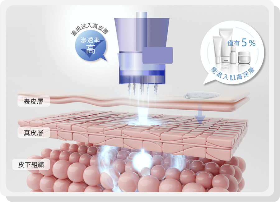 hydroinjection infographic