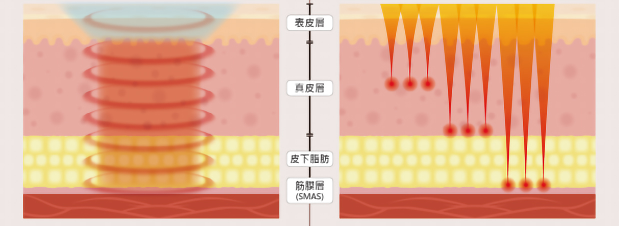 info graphic